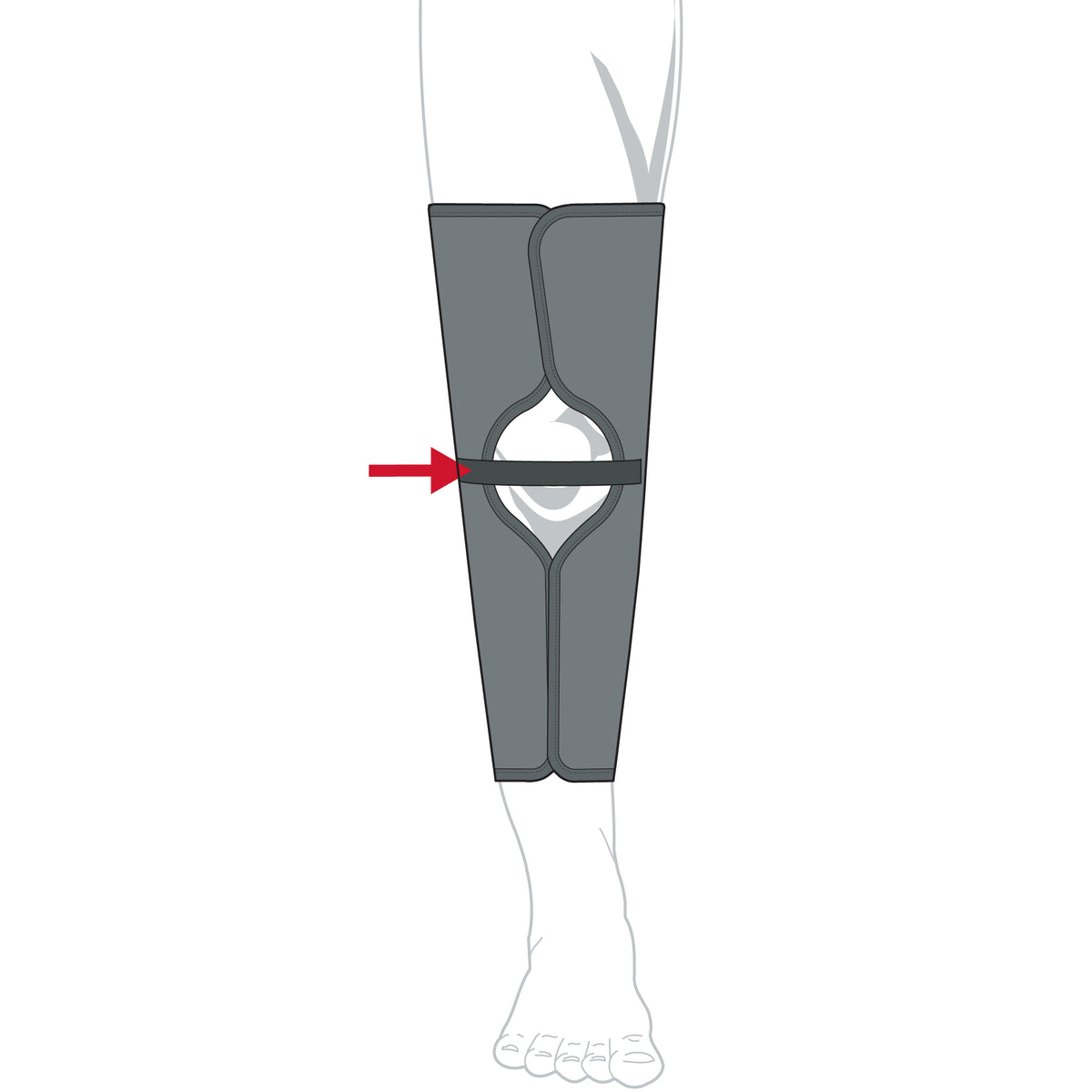 Sized Knee Immobilizer – Adjustable Moldable-Stay Orthosis
