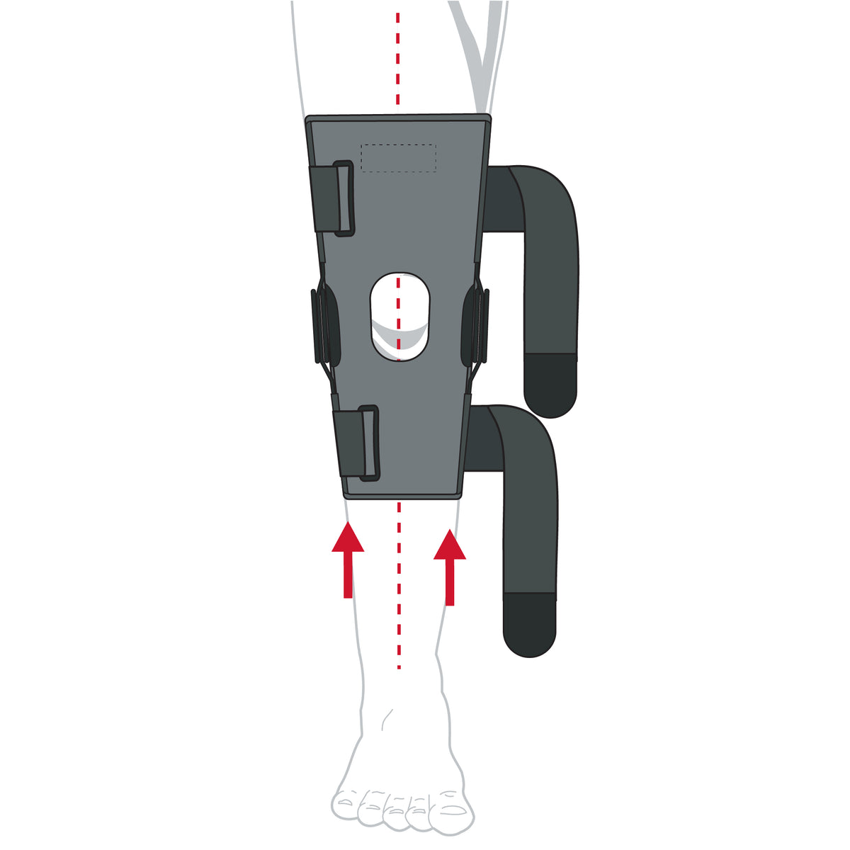 Rally Hinged Knee Brace (Pull-Up) – Adjustable Dual-Axis Support