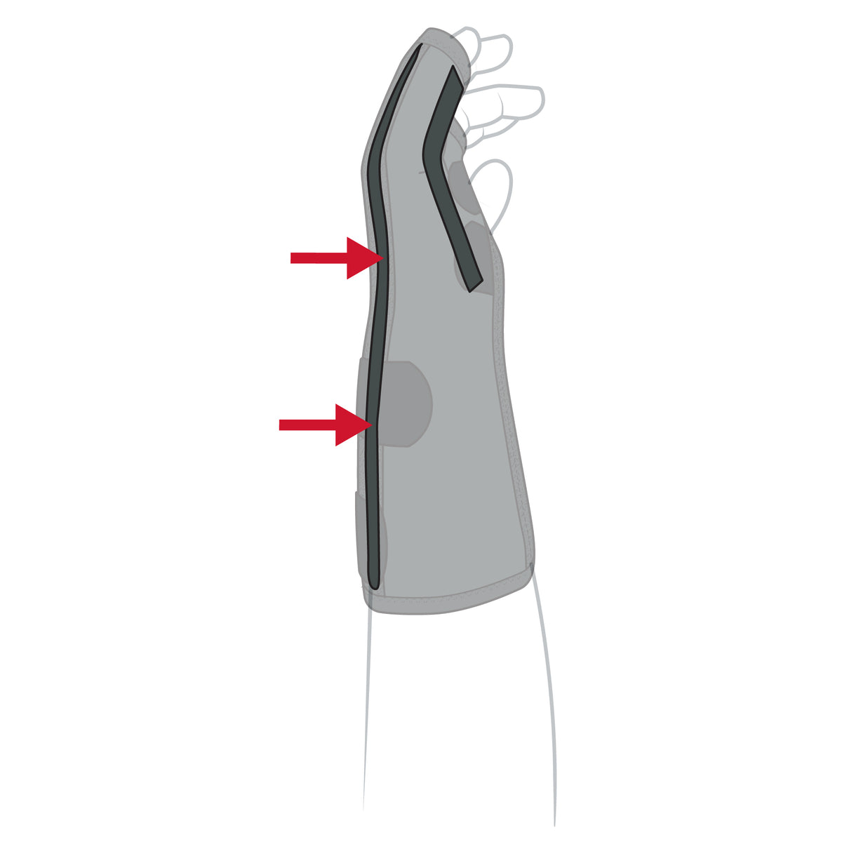 Diagram showing Boxer Orthosis wrist brace positioning for boxer fracture treatment - 283265, 283262, 283266, 283263, 283267, 282550, 283268, 283264